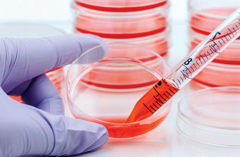 Global Cell Culture Market