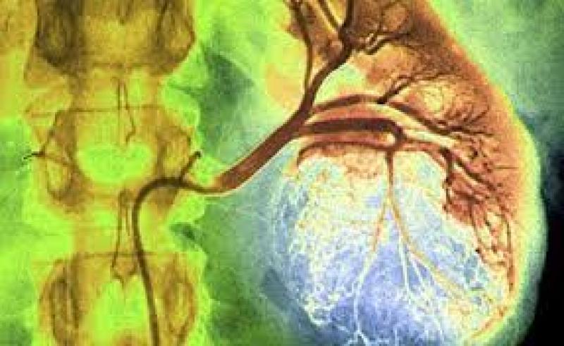 Global Kidney Cancer
