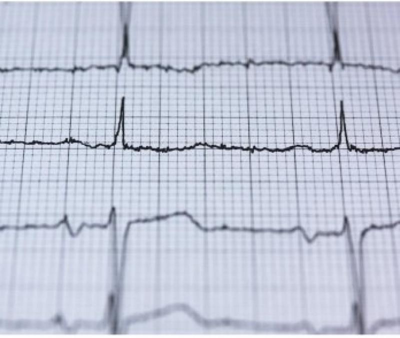 Interventional Cardiology Devices And Equipment Market
