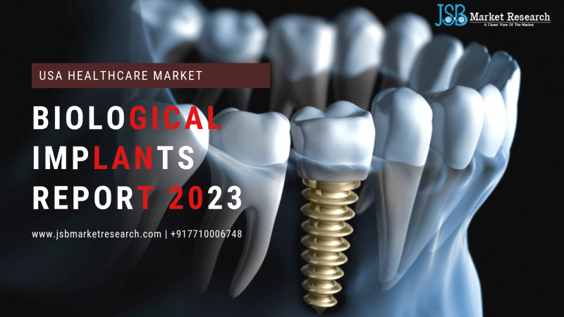 Biological Implants-United States Market Status and Trend Report 2013-2023