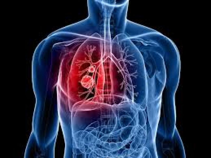 Lung Cancer Therapeutics Market