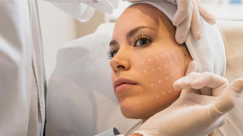 Mesotherapy Market