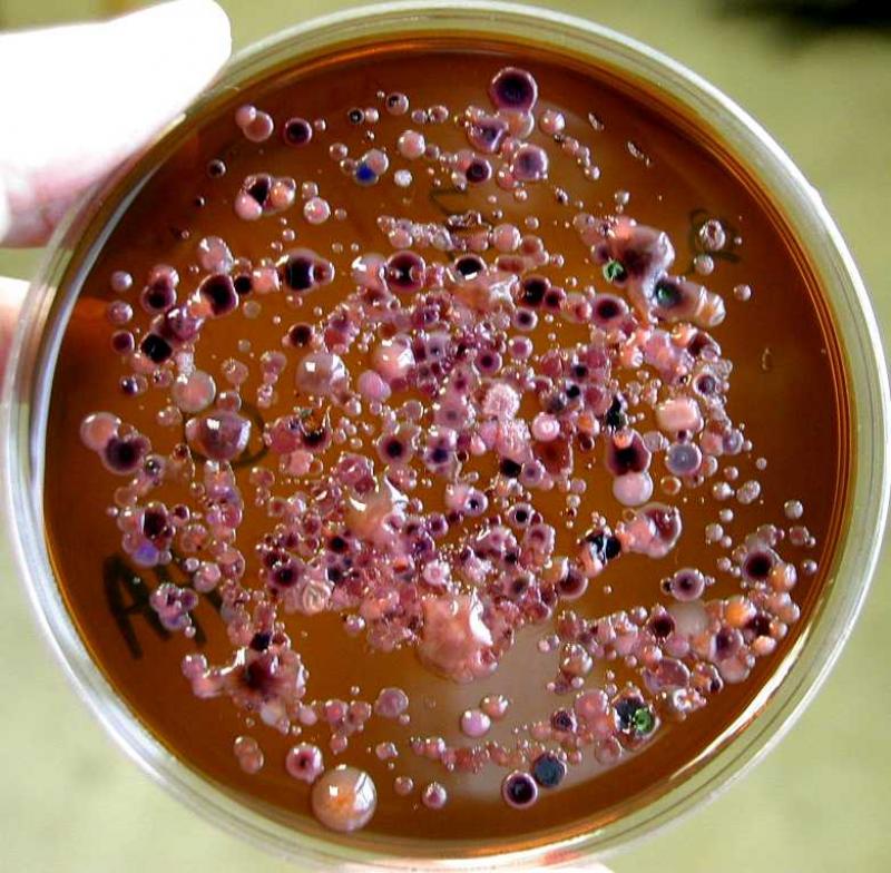 Microbiology Culture