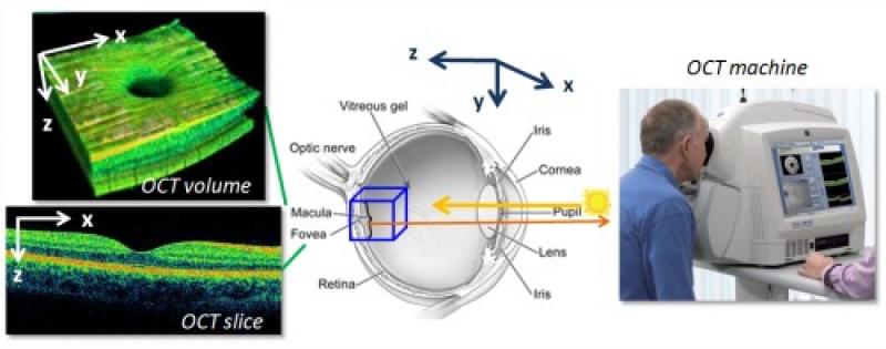 OCT Imaging System