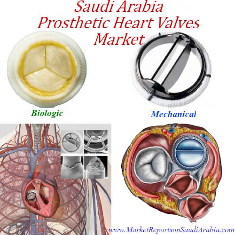 Prosthetic Heart Valves