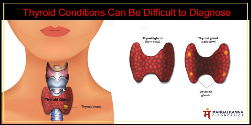 Thyroid Function Test Thyroid Function Test