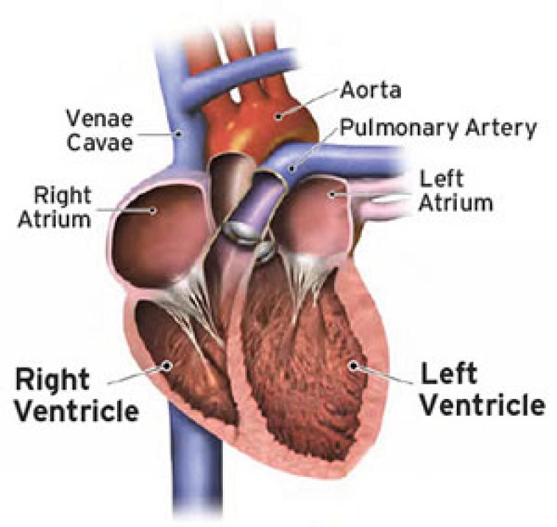 Total Artificial Heart