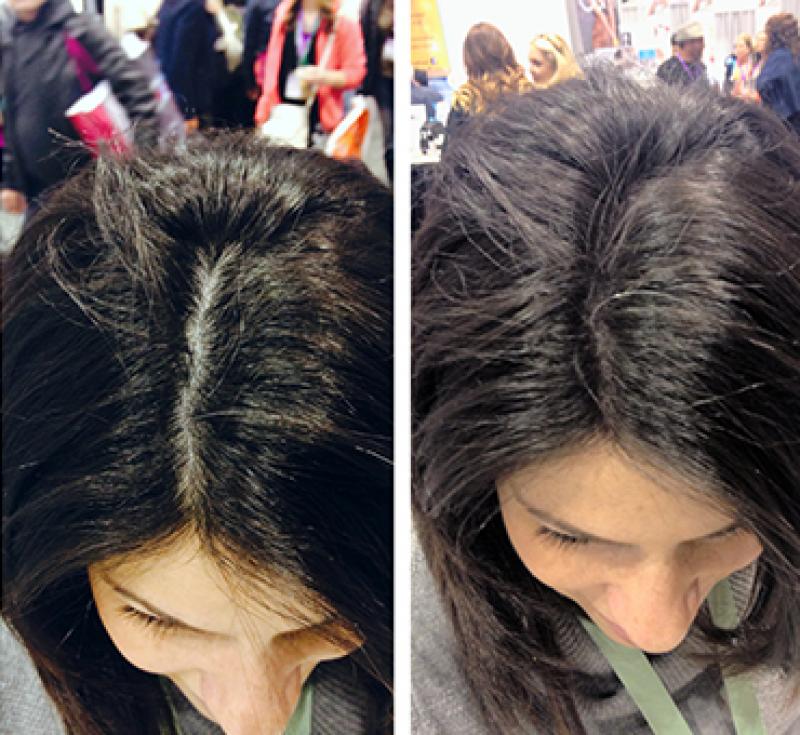 Natural Hair Wigs For Men in Mumbai 