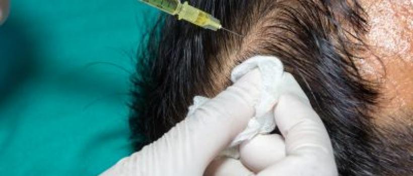 زراعة الشعر في تركيا