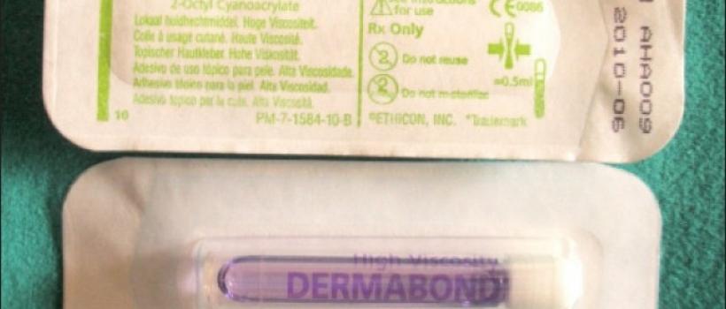 2-Octyl Cyanoacrylate Adhesives 