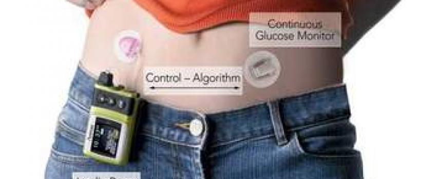 Artificial Pancreas Market