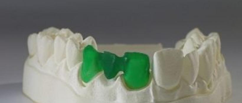 3D Dental Scanners 