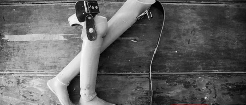 3D-Printing- Medical-Devices