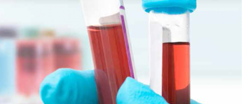 A latest addition to the DecisionDatabases.com repository is the addition of United States Blood Collection Monitors Industry 2016 Market Research Report. The report along with the industry analysis gives a detailed account of big manufacturers and producers of the industry.