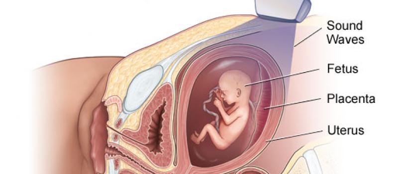 Achondroplasia Treatment Market