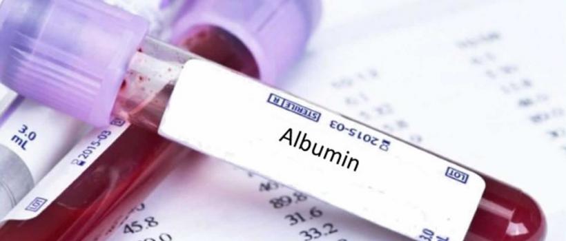 Albumin