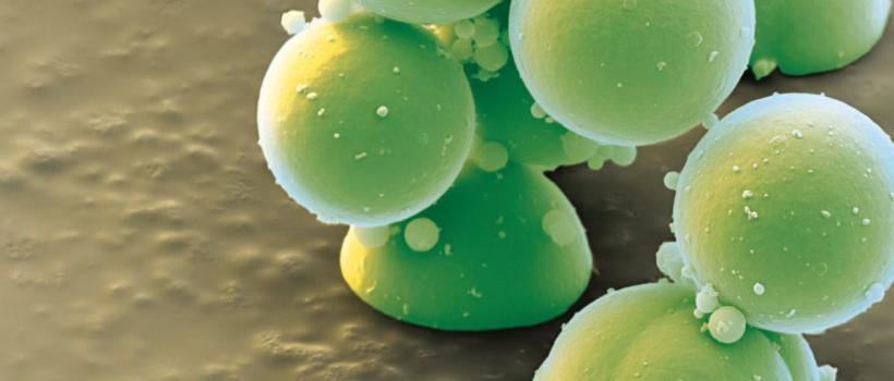 AlkaliSwellable Acrylic Polymers