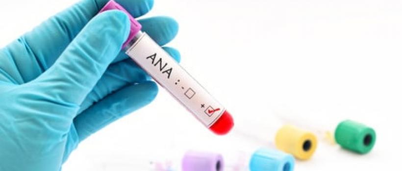 Anti-nuclear Antibody (ANA) Testing Industry 
