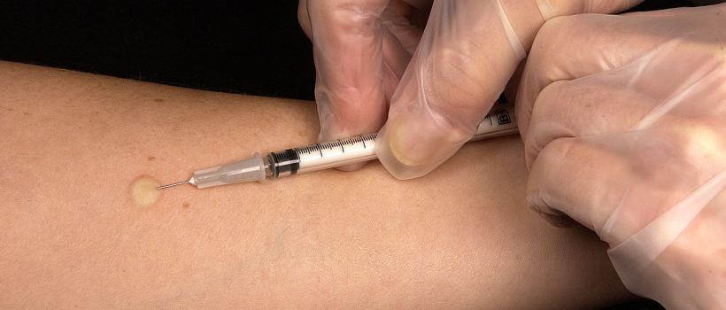 Antigen Skin Test Market 