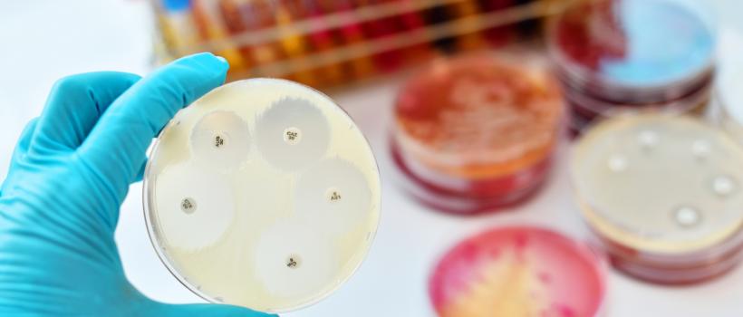 Antimicrobial Susceptibility Testing Market 