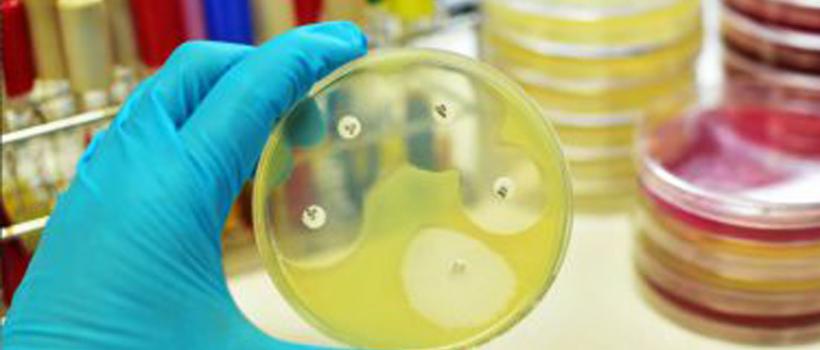 Antimicrobial Susceptibility Testing Market