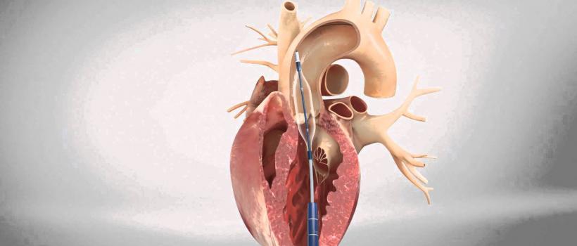 Aortic Stenosis Market 