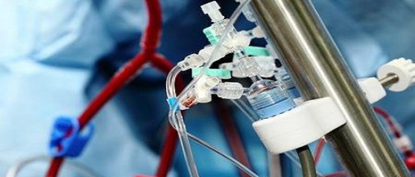 Artificial HeartLung Machine