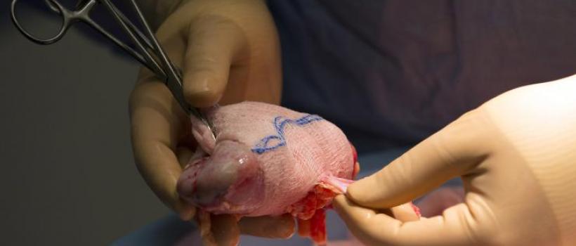 Artificial Kidney Market