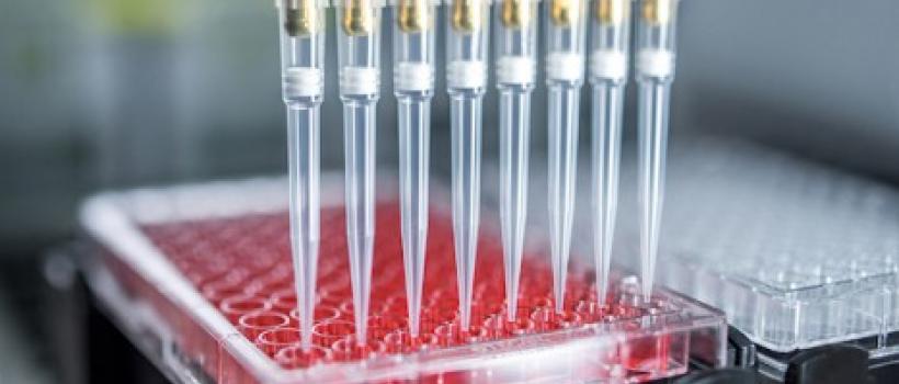 Automated Liquid Handler, Automated Liquid Handler Market, Automated Liquid Handler Market Growth