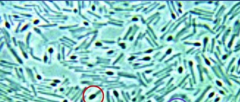 Bacillus Coagulans Market