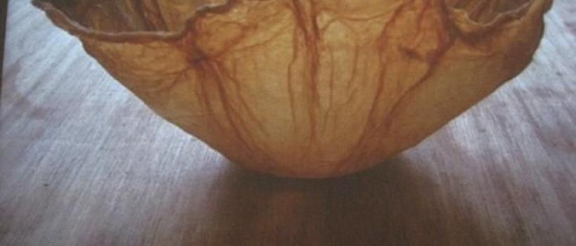 Bacterial Nanocellulose Market