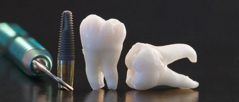 Bioceramics, Bioceramics Market , Bioceramics Market Growth