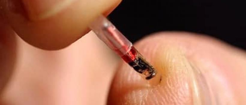 Biochips Market