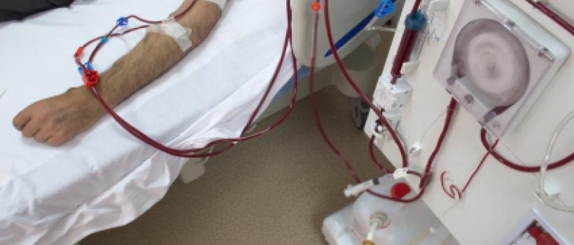 Blood Dialysis Machines 