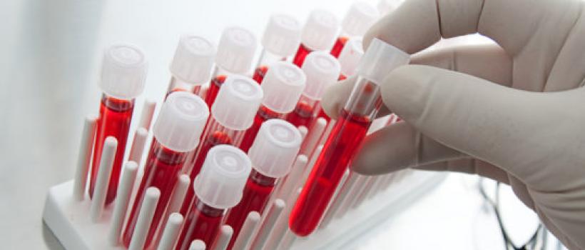 Blood Screening