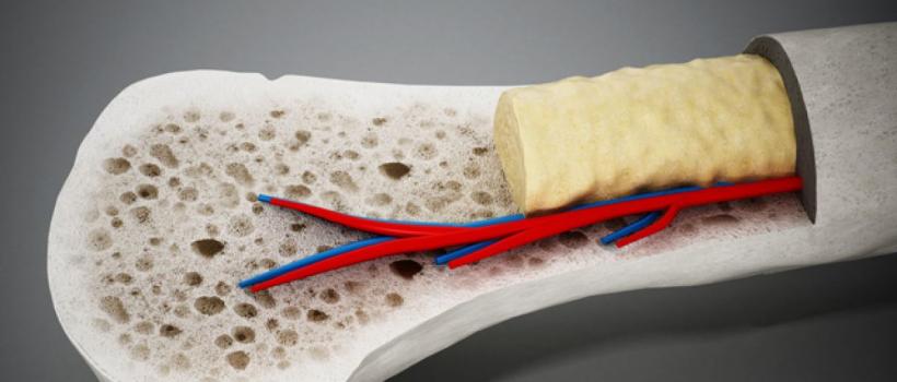 Bone Marrow Transplant Market
