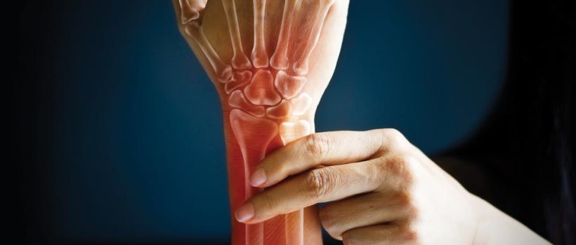 Bone and Joint Health Ingredients