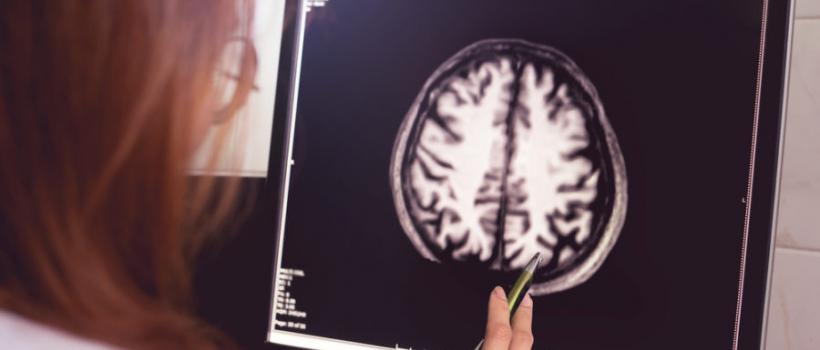 Brain Implants Market