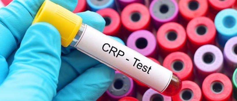 C-Reactive Protein (CRP) Test