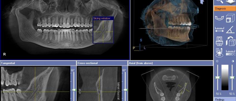 CBCT Dental Imaging Market