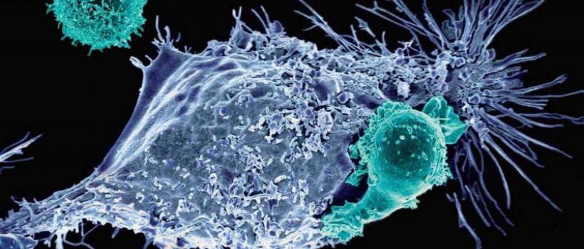 Cancer Immunotherapy