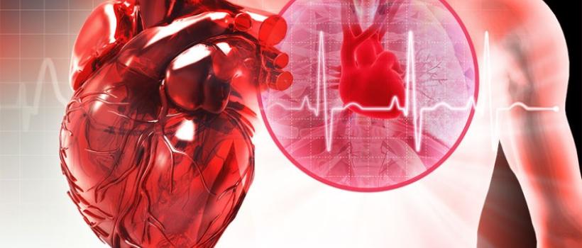 Cardiac Arrhythmia Monitoring Devices