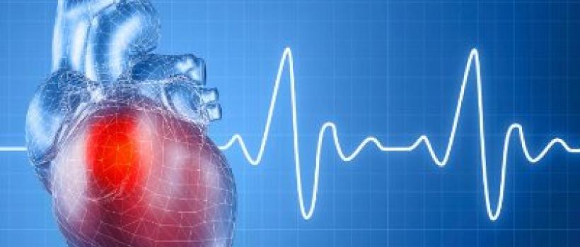 Cardiovascular Devices