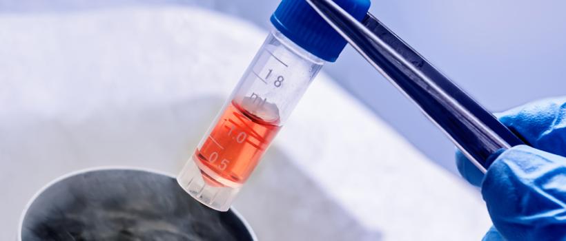 Cell Cryopreservation