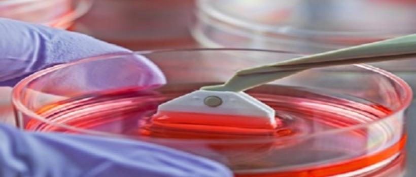 Cell Harvesting Market