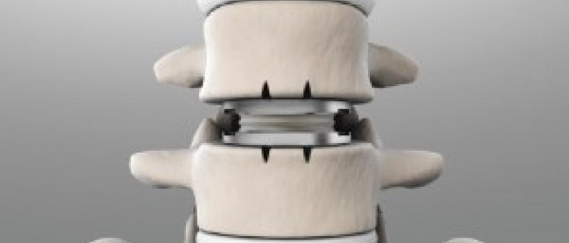 Cervical Total Disc Replacement Device Market
