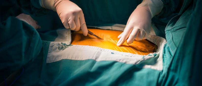 Chest and Cardiac Surgeons Email List