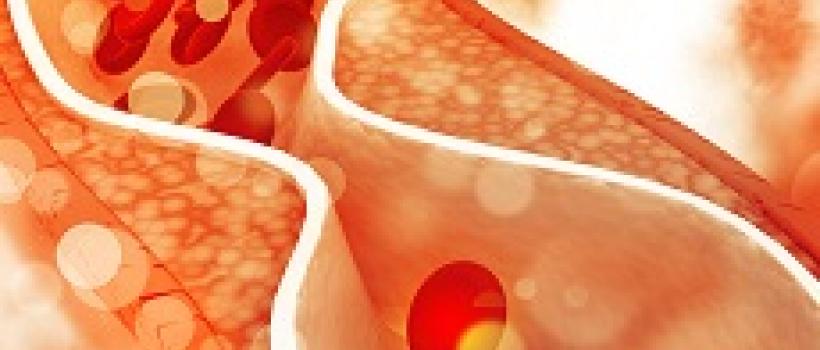 Cholesterol Medicines