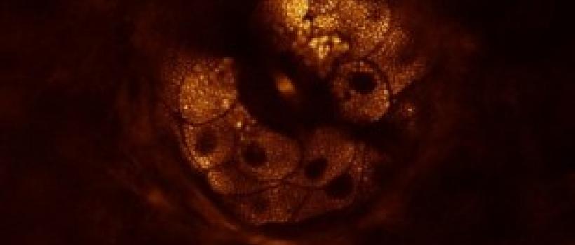 Coherent Anti-Strokes Raman Scattering Microscopy