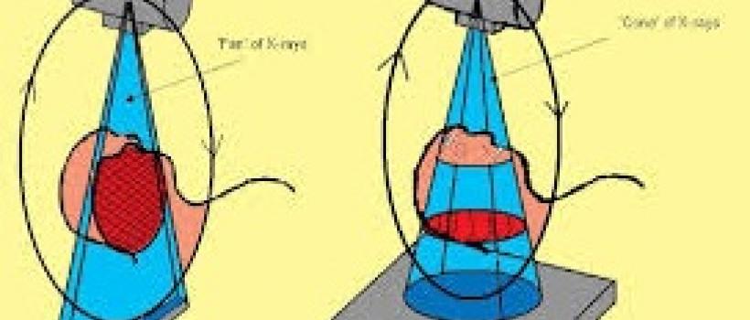 Cone Beam Computed Tomography Market